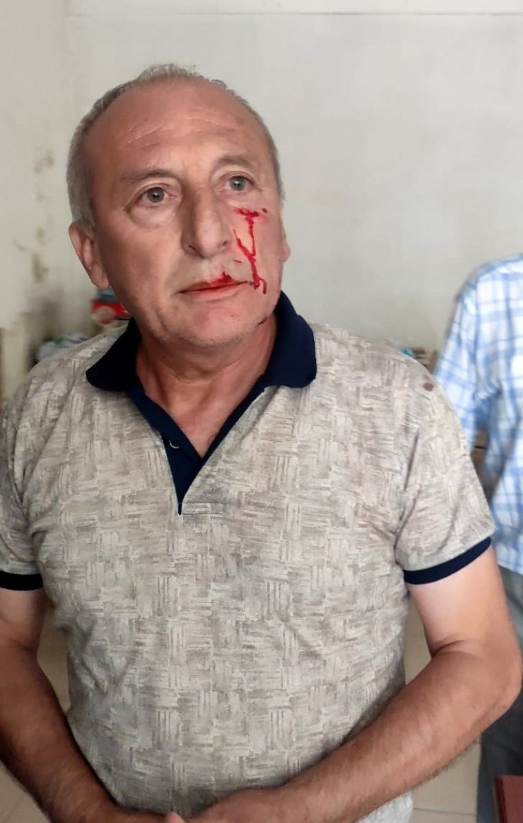 YARBAŞI BELEDİYE BAŞKANI MUSTAFA KAYNAR SALDIRIYA UĞRADI